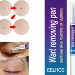 Wart Removing Pen - Image 4